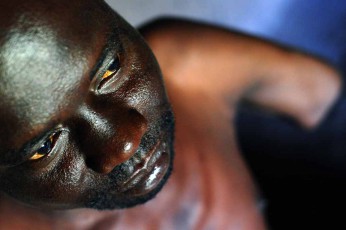 21jpg Uganda, victims of LRA, the Lord's Resistance Army.