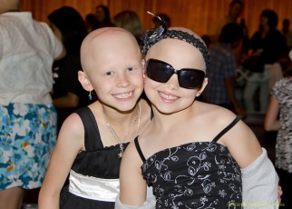 alopecia-girls